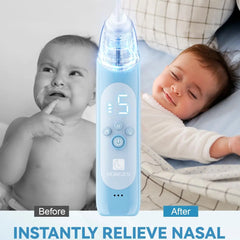 Nasal Aspirator for Baby, Electric Baby Nose Suction with 5 Adjustable Levels Suction, USB-C Rechargeable Mucus Cleaner with Lights and Music, Baby Nasal Aspirator for Toddler with 3 Silicone Tip